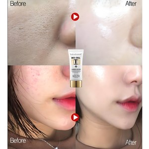 마테카 시카 회복BB/회복 파운데이션/레이져후에도 커버력up, 1개, 프리