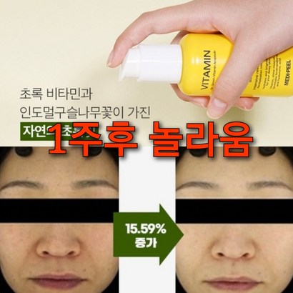 닥터 폴리페놀 32배 피부빛 개선앰플/물광 빛앰플 다크닝피부