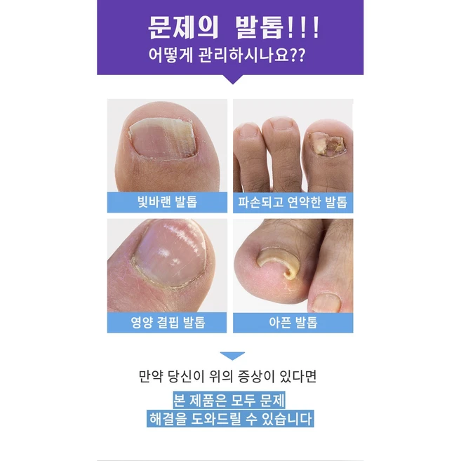 [당일배송] DRYMATINE 발톱무좀 내성발톱 곰팡이 살균 발톱, 2개, 30ml