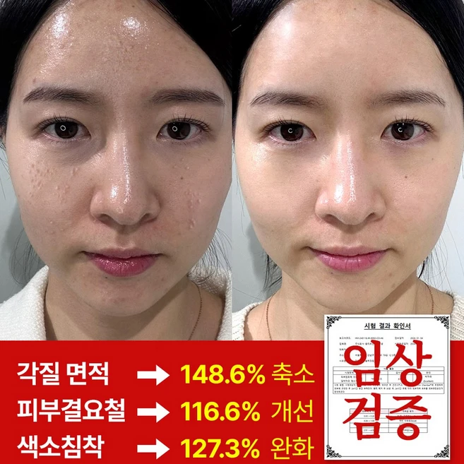 마미케어 한방 요철 피부결 좁쌀 율무크림, 2개, 50g