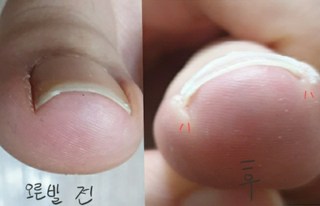 갤러리 이미지
