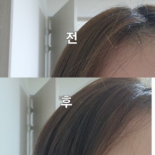 갤러리 이미지