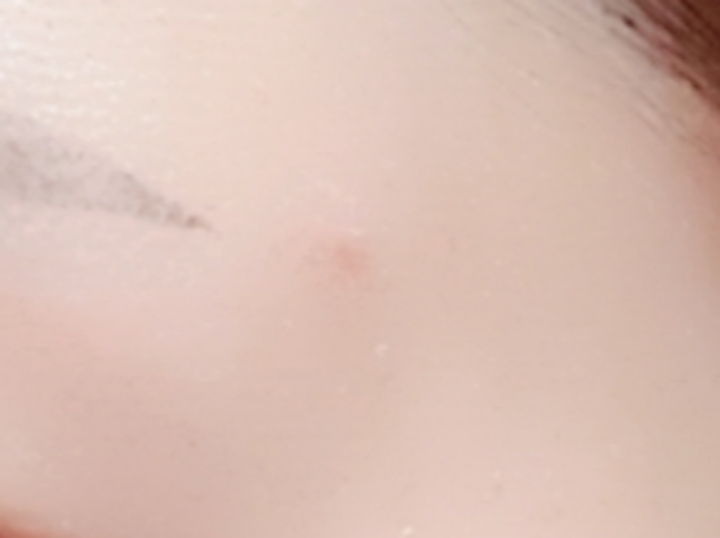 해서린 스팟패치 리뷰후기