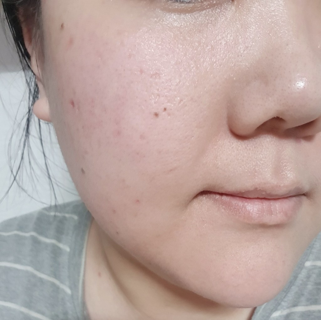 닥터에이지 시카 히알루로닉 카밍 앰플 리뷰후기