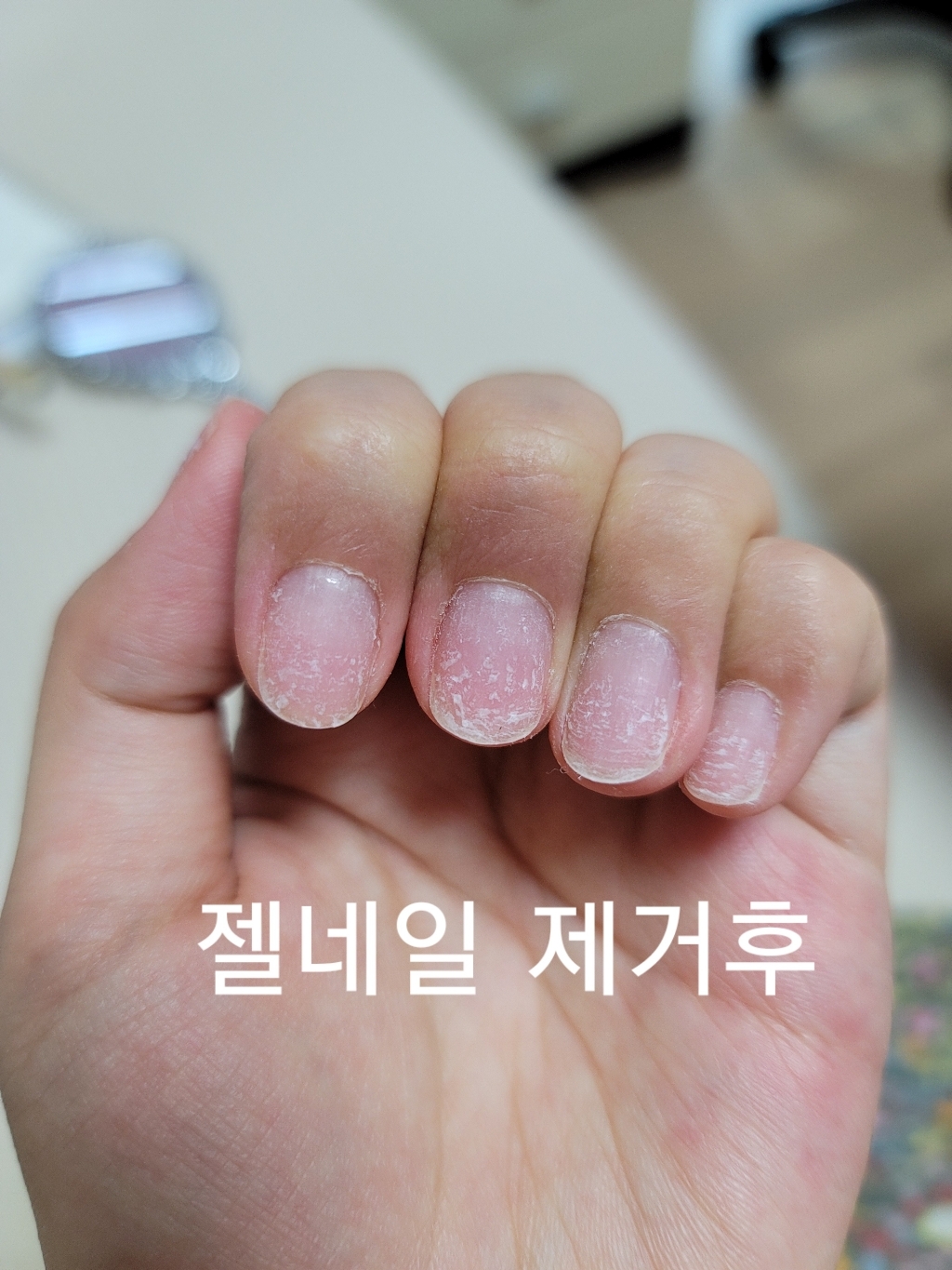 수운수 손톱 영양제