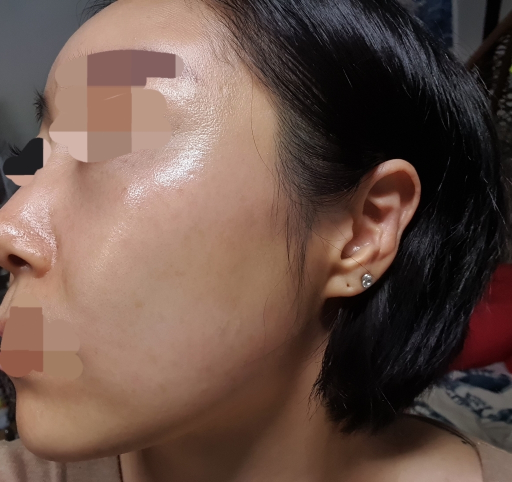 시카보다 좋은 피부 트러블 진정 수분공급 마치현 인텐시브 카밍 앰플