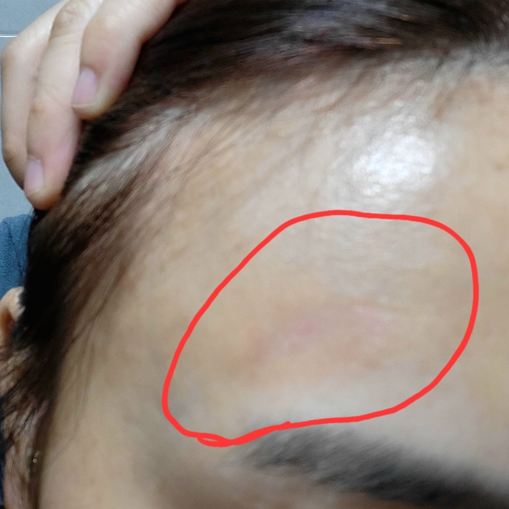 JW중외제약 하이맘밴드 더프리미엄 소형 6매