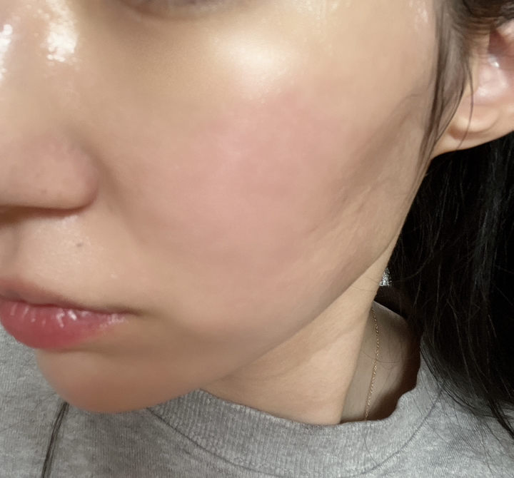 마일드랩 센텔라스카 연고