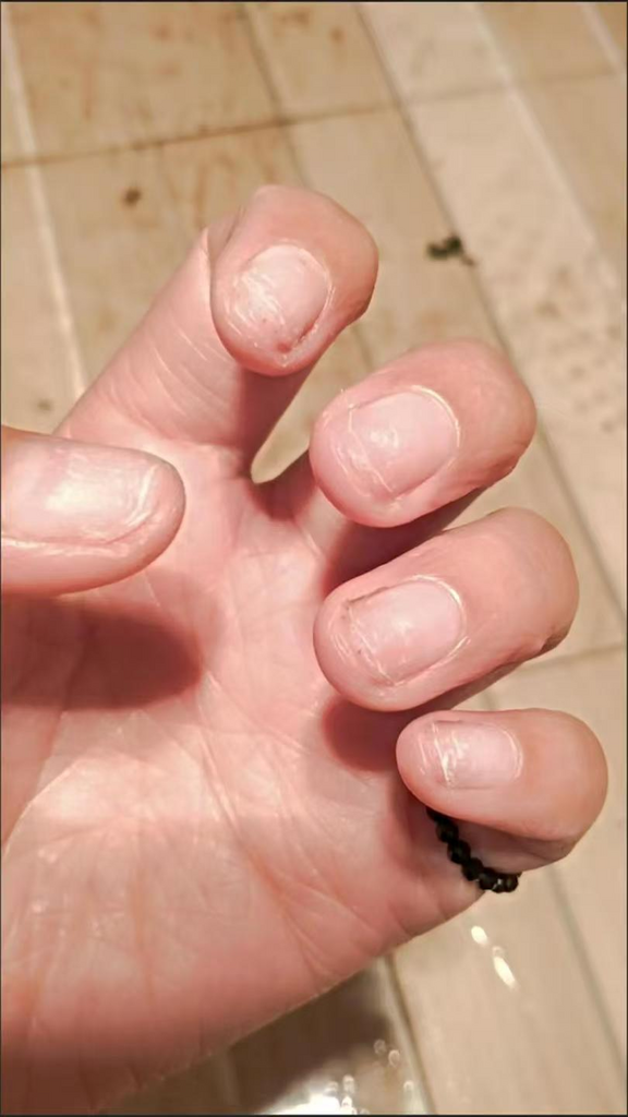손톱재생 케어 손톱영양제 강화제 문제성 손톱 보조제 큐티클오일 윤기있는 건강한 손톱만들기 손톱 영양제 오일펜 짧은 손톱 고민 해결, 1개, 10ml