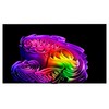 LG전자 4K UHD OLED evo AI TV, OLED65G6KNA, 방문설치, 벽밀착 벽걸이형, 163cm(65인치)