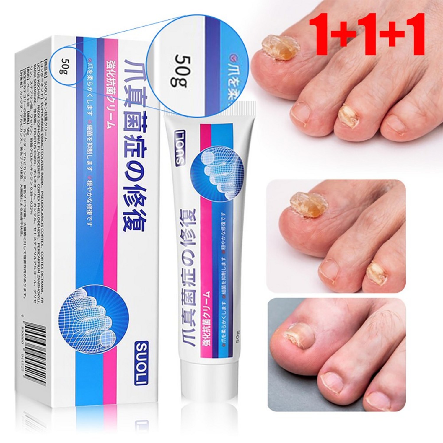 발톱무좀 손발톱 케어 전용 쓱싹크림, 50g, 1개입, 3개