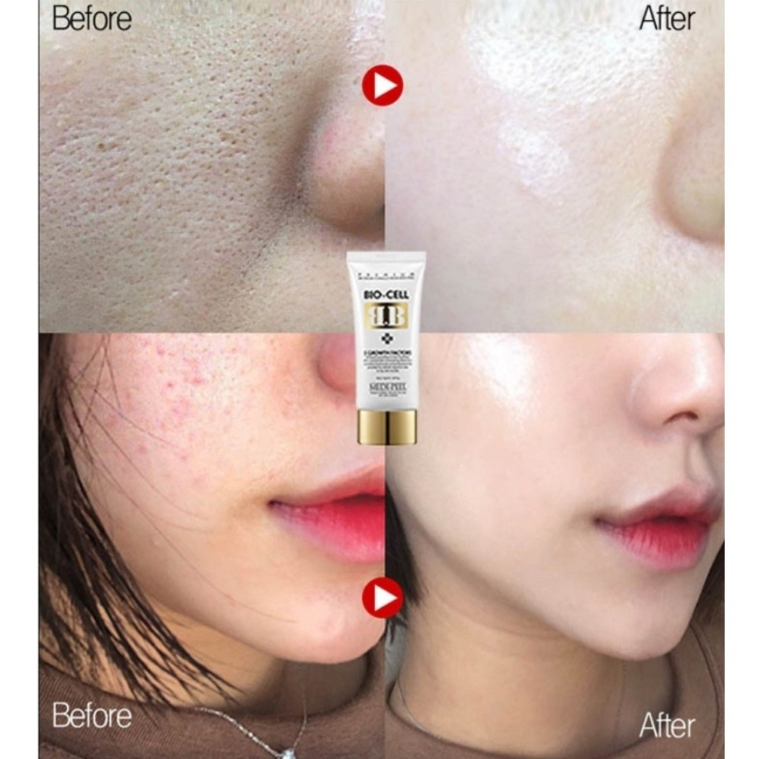 마테카 시카 회복BB, 피부를 위한 완벽한 선택 재생비비