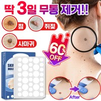 [빠른배송] 피부 제거 패치 얼굴 바디 피부 치료 라벨 스텔스 포장증정, 145매입, 3개