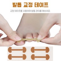 화살표형 내성발톱테이프 교정 4p