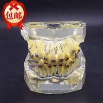치아 모형 재료상 입모형 칫솔질 모형 치아 치과 충치 교구 착악교정전시모델 자스톨홈 교정구, 01 투명x턱정교모델