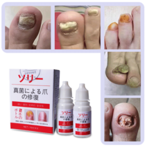 발톱무좀 리페어 세럼 발톱연화 발톱 무좀 조갑사상균증 살균, 2개, 10ml