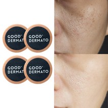 굿더마토 알부틴+ 레드팜화이트 115g (즉각화이트닝 백옥주사비누 천연수제비누 기미잡티 싹 미백비누), 4개