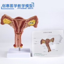 인체모형 의료 여성 자궁 난소 모형 산부인과, 기본