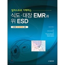 일러스트로 이해하는 식도 대장 EMR과 위 ESD:안전한 내시경치료 요령, 대한의학(대한의학서적), 설상영 역