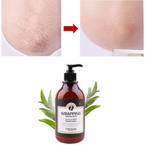팔뚝 등 모공각화증 크림 모공각화 여름용바디로션 팔 각질 제거 겨울철피부가려움 매끈한피부