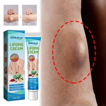 Lipoma Removal Ointment Lipolysis Fat Lump Relief Pain Treat Skin Swelling Nodule Cream Anti-tumor P, [02] 20g x 2pcs