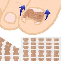 제이와이홀딩스 파고드는 내성 발톱 붙이는 교정 테이프 30P, 10P*3장(총30P)