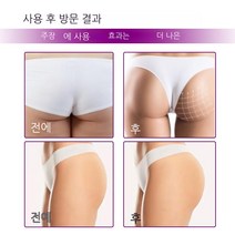 TTiiHot 성형 힙업 마사지 크림, 30g×3병