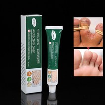 스킨 케어 손 발 항진균 크림 20g 무좀 피부 관리 운동 선수 발 가려움증 타는듯한 갈라진 스케일링 곰팡이 감염