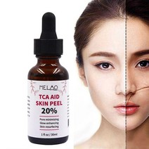 스킨케어 세럼 에센스 30ml Tca Aid Skin Peel Trichloroaectic Acid 20% 스킨 필 모공 주름 케어 페이스 세럼, 1개