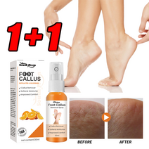 1+1 무좀 발 관리 스프레이 풋 필링 스프레이 60ml, 1개, 1개