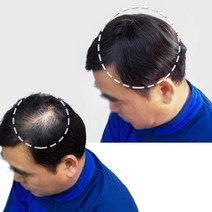 남성용 정수리 탈모가발 고열사가발 부분가발 덮어, 내츄럴브라운