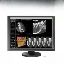 병원 스크린 모니터 판독용 진단 패널 내시경 작업용, EIZO MX215 스톡 효과 등급