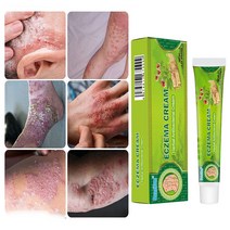 BT 피부 가려움증 연고 모낭염 두피 습진 건선연고 지루성피부염 치료, 2개, 20g