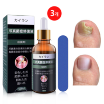 Idun 발톱무좀 손톱 발톱 진균 치료연고 발톱강화 손발톱케어 무좀 살균연고, 20g, 3개