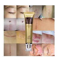 Acne Scar Removal Cream Stretch Marks Face Skin Repair Cream Shrink Pores Gel-Fa