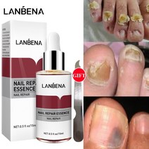 무좀 내성발톱 발톱무좀 LANBENA-네일 리페어 에센스 곰팡이 제거 젤 손발톱 진균증 감염 방지 손 발 치, 한개옵션0