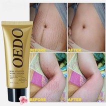 로즈는 산후 비만을 제거하기 위해 스트레치 마크 크림을 제거합니다. 임산부 수리 안티 에이징 안티 윙클 퍼밍 바디 크림, 보여진 바와 같이