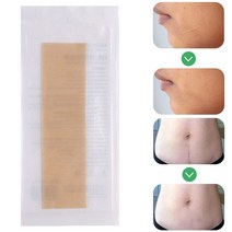 흉터 치료 실리콘 제거 스티커 테이프 고효율 수술 겔 흉터 치료 여드름 상처 화상 흉터 커버 피부 복원, 상품 상세페이지 참조