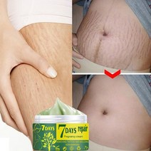 효과적인 임신 흉터 제거 여드름 크림 스트레치 마크 치료 출산 안티 에이징 링클 퍼밍 바디, [02] 50g