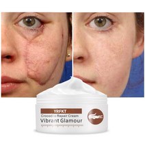 악어 리페어 스카 트러블 크림 페이셜 트리트먼트 리페어 크림 스트레치 마크 트리트먼트 화이트닝 데이 크림, 01. 50G