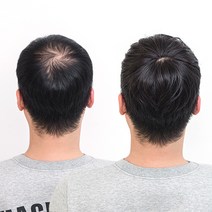 가발나라 정수리가발 멀티섹션O 부분가발, 내츄럴블랙-10cm, 1개