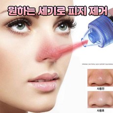 토소웅피지제거기
