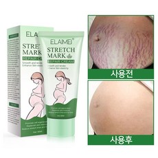 튼살크림 임산부 튼살관리 산후 튼살 제거 60ml 2개