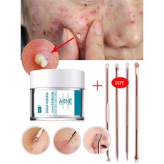 여드름뿌리뽑기