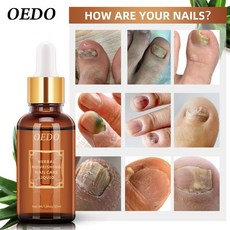 티타니아손톱영양제