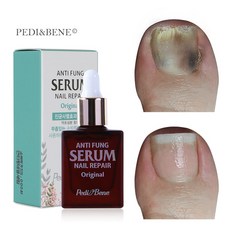 뷰젤 안티펑 네일리페어 세럼 오리지널 스포이드 10ml, 1개