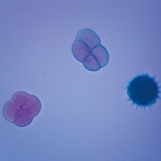 현미경프레파라트