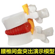 장기모형 한의원 모형 추체병리추간판신경 돌출시연 정골교습 의료용 인체추나, 오류 발생시 문의 ( 엠디리얼티 2 )