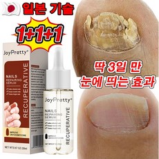 [효과보장] 손톱 발톱 강화 무좀 문제성 무좀 전문 영양제 100% 효과 있음, 3개, 20ml