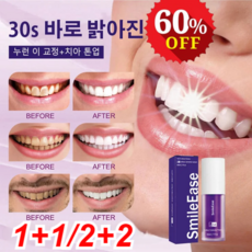 [1+1] SmileEase 화이트닝 치약 치아 생얼크림 니코틴산아미드 미백치약 30ml*2/4/8누런 이 교정+ 치아 톤업, 화이트닝 치약 30ml*2+2